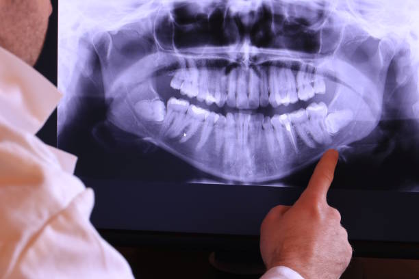 Best Chipped Tooth Repair Near Me  in South Pottstown, PA